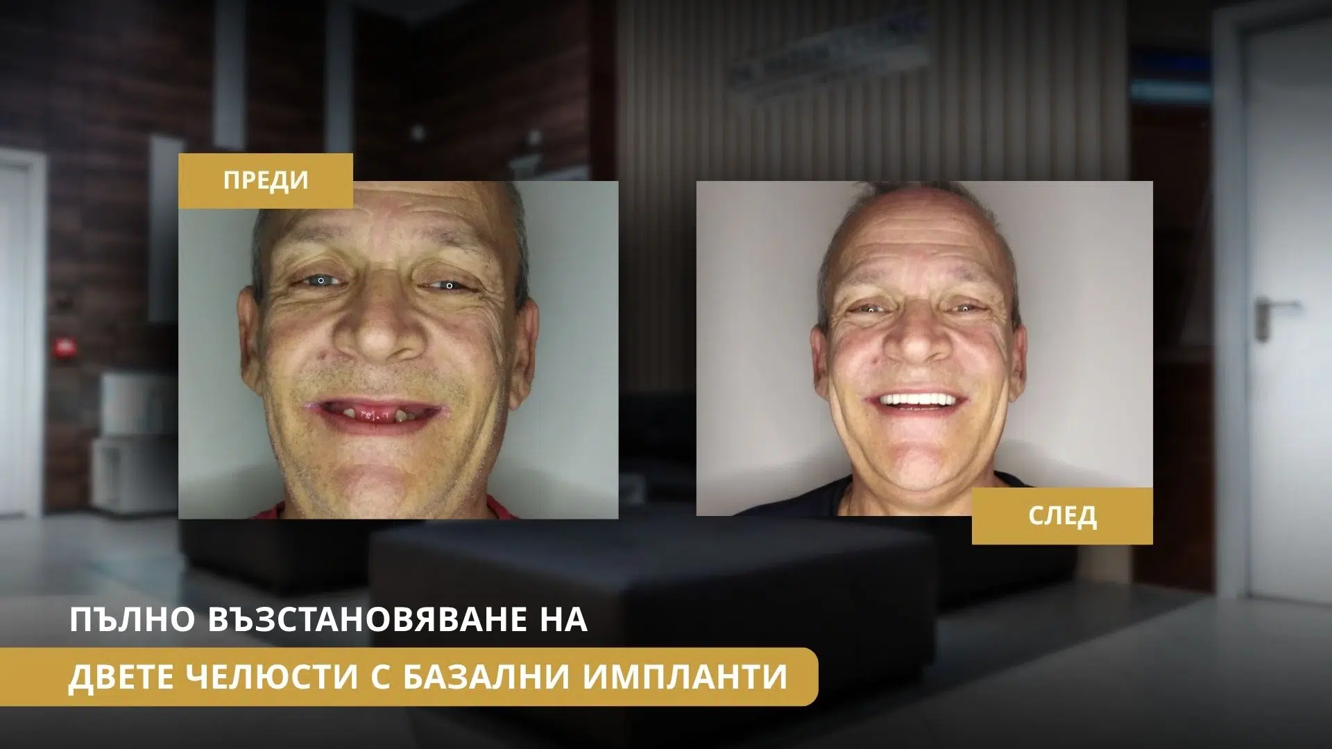 Базални импланти след неуспешна имплантация: Възможно ли е възстановяване без костно присаждане?